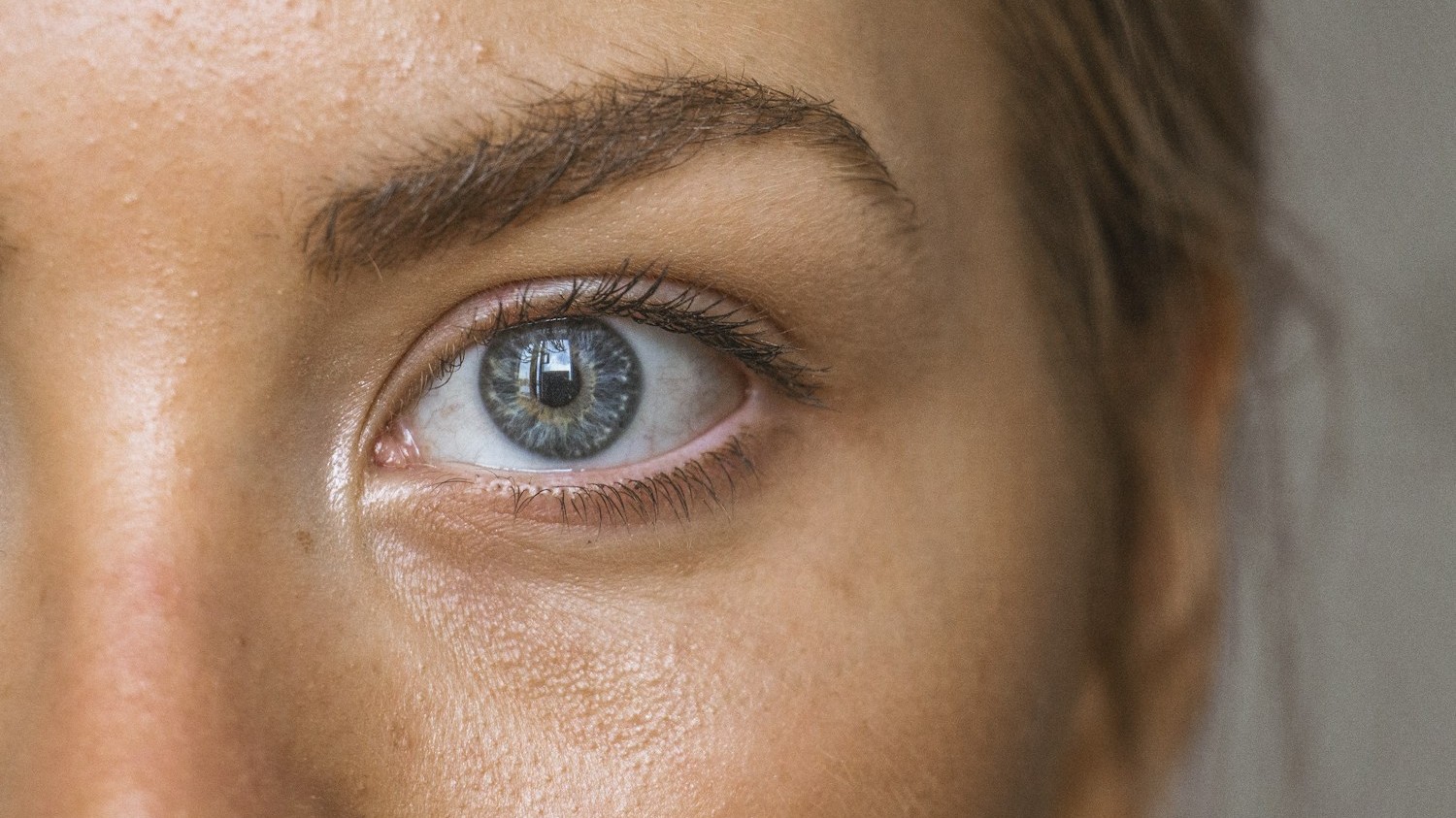 Acide Tranexamique : le dépigmentant qui bat l'Hydroquinone ?